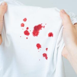 Como Remover Manchas de Sangue de Tecidos: Dicas Práticas e Fáceis